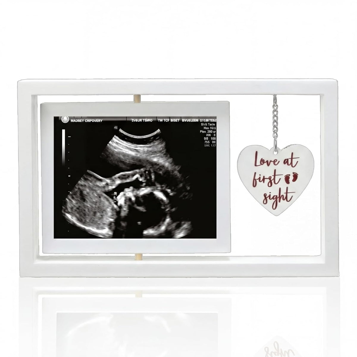 BrightRow Ultrasound Picture Frames