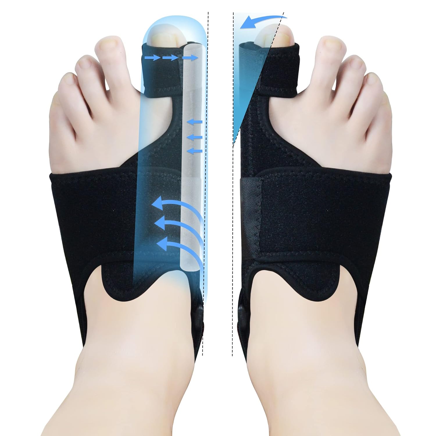 Bunion Corrector (1 pair)