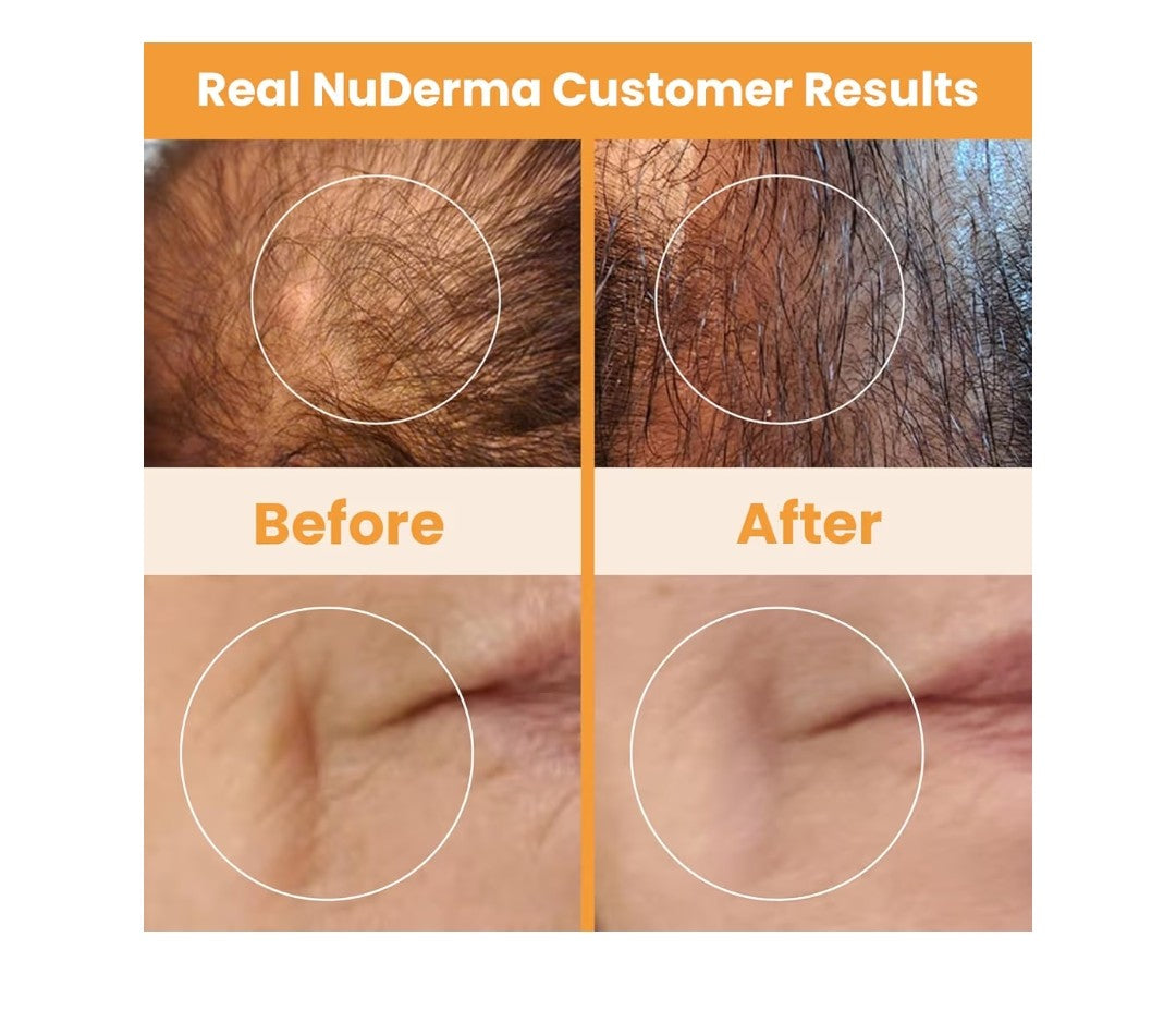 Pure NuDerma Cell Energy Amplification System